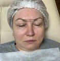 Микроблейдинг в Солнцево